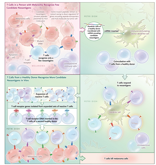 Figure 1. Outsourcing Cancer Immunity.Cancer cells harbor many mutations that produce potentially immunogenic mutant proteins that are, however, not recognized by the patient’s immune system. Strønen et al.4 recently reported a means of identifying donor-derived T-cell responses to such mutations. Using computer-based prediction algorithms, they first selected candidate neoantigens among peptides encoded by mutations from tumors of three patients with melanoma that — in theory — seemed likely to elicit an immune response. These mutant peptides were then synthesized and expressed in antigen-presenting (dendritic) cells obtained from a healthy donor and were coincubated with T cells from that same person. Neoantigen-reactive T cells activated by some of these transduced dendritic cells multiplied, and the “potent” T-cell receptor genes were isolated. T cells from a second healthy donor, when genetically engineered to express the neoantigen-reactive T-cell receptors, were shown to destroy tumor cells derived from the original melanomas. mRNA denotes messenger RNA.